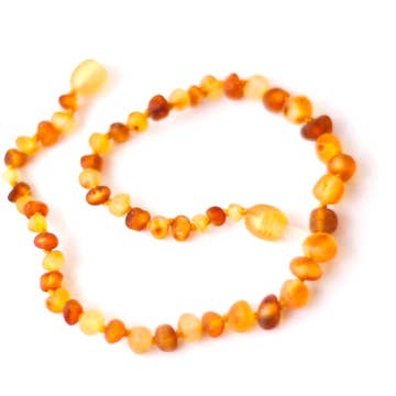 Healing Amber | Amber Necklaces, Assorted Styles